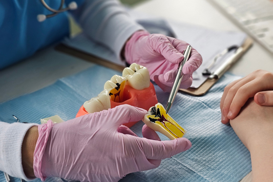 Root Canal Therapy For A Tooth Infection